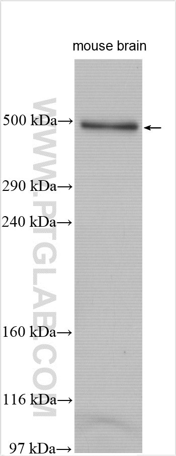 FRAS1 Antibody in Western Blot (WB)