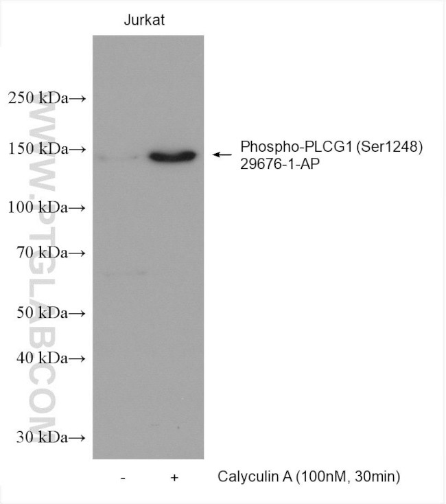 Phospho-PLCG1 (Ser1248) Antibody in Western Blot (WB)