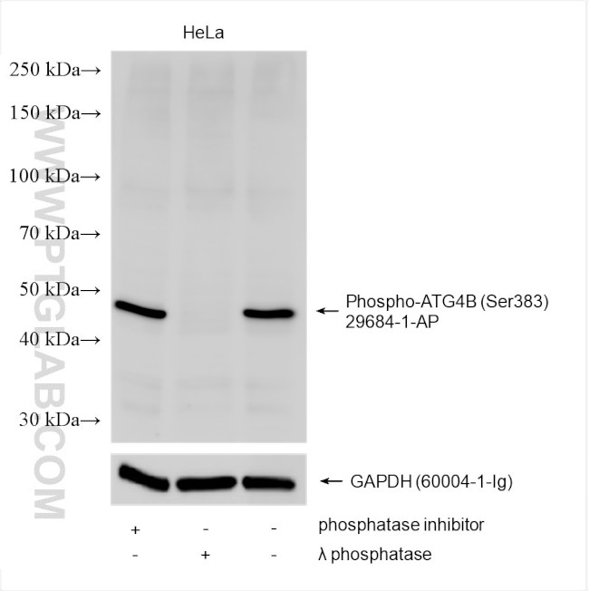 Phospho-ATG4B (Ser383) Antibody in Western Blot (WB)