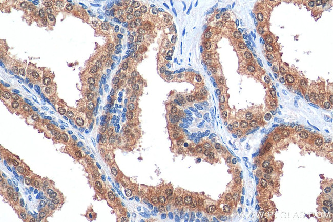 PGM3 Antibody in Immunohistochemistry (Paraffin) (IHC (P))