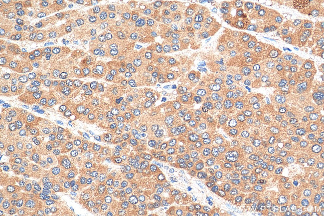 GGPS1 Antibody in Immunohistochemistry (Paraffin) (IHC (P))