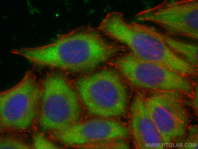 EIF4E Antibody in Immunocytochemistry (ICC/IF)