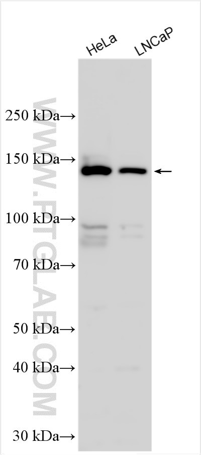 ABL1 Antibody in Western Blot (WB)