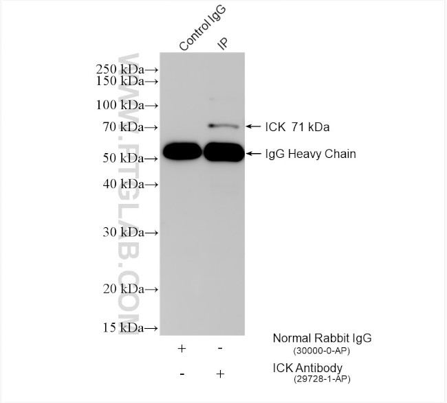 ICK Antibody in Immunoprecipitation (IP)