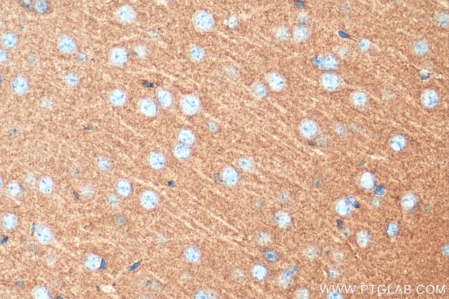Synaptogyrin 1 Antibody in Immunohistochemistry (Paraffin) (IHC (P))