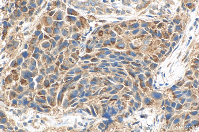 BIRC6 Antibody in Immunohistochemistry (Paraffin) (IHC (P))