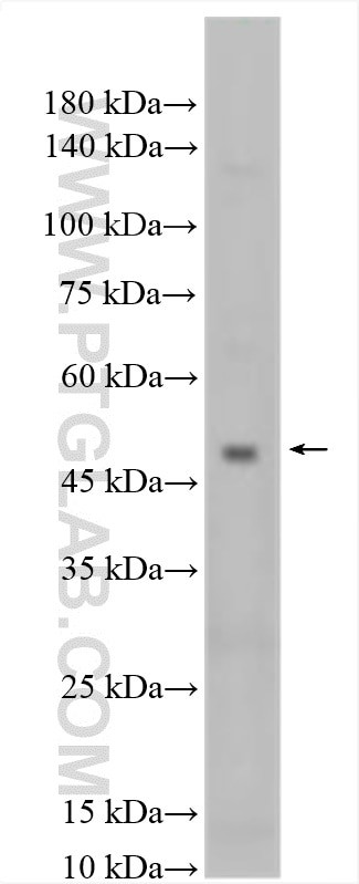 KCNK12 Antibody in Western Blot (WB)
