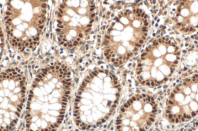 POLD2 Antibody in Immunohistochemistry (Paraffin) (IHC (P))