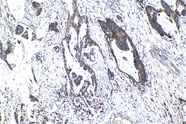 ATF7 Antibody in Immunohistochemistry (Paraffin) (IHC (P))