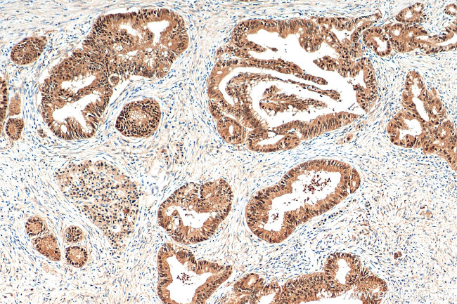 SENP2 Antibody in Immunohistochemistry (Paraffin) (IHC (P))