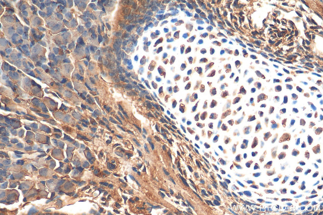 SCPEP1 Antibody in Immunohistochemistry (Paraffin) (IHC (P))