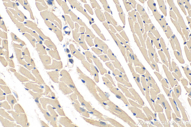 KANK1 Antibody in Immunohistochemistry (Paraffin) (IHC (P))