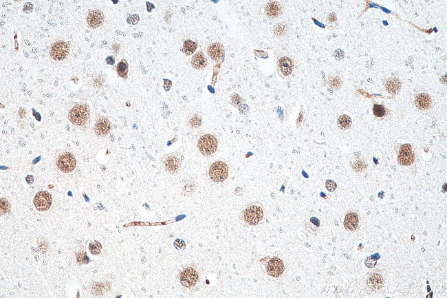 CHD8 Antibody in Immunohistochemistry (Paraffin) (IHC (P))