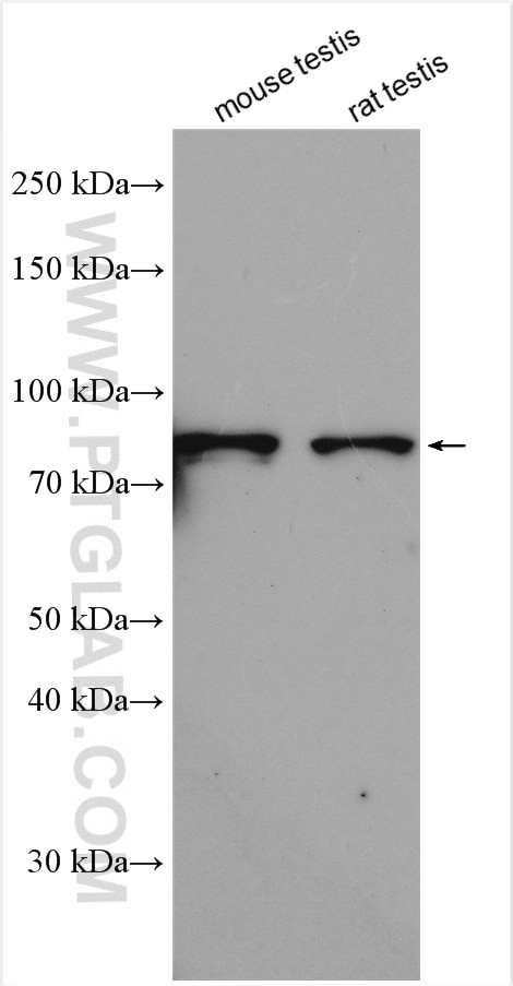 NSUN7 Antibody in Western Blot (WB)