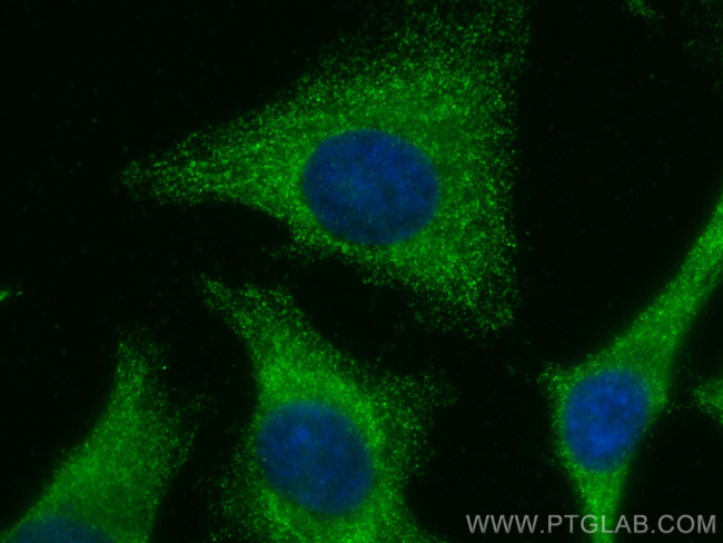 PRSS1 Antibody in Immunocytochemistry (ICC/IF)