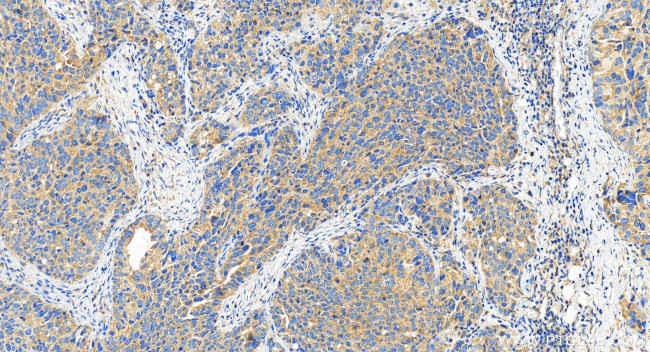 ABCC5 Antibody in Immunohistochemistry (Paraffin) (IHC (P))