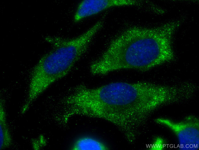 WNT5A/B Antibody in Immunocytochemistry (ICC/IF)