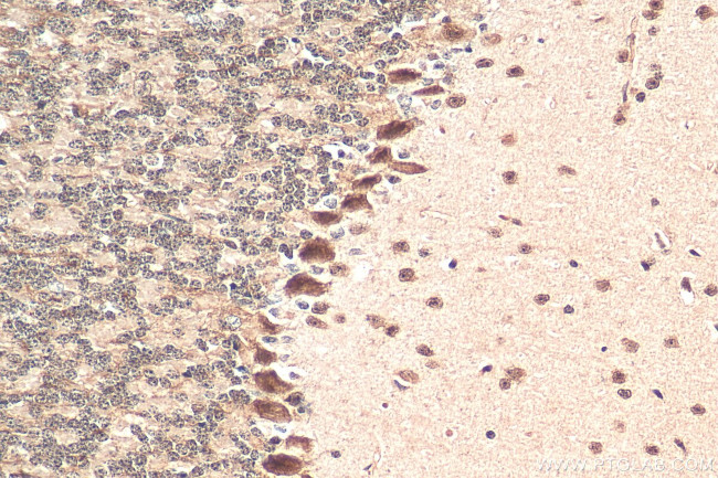 NOM1 Antibody in Immunohistochemistry (Paraffin) (IHC (P))