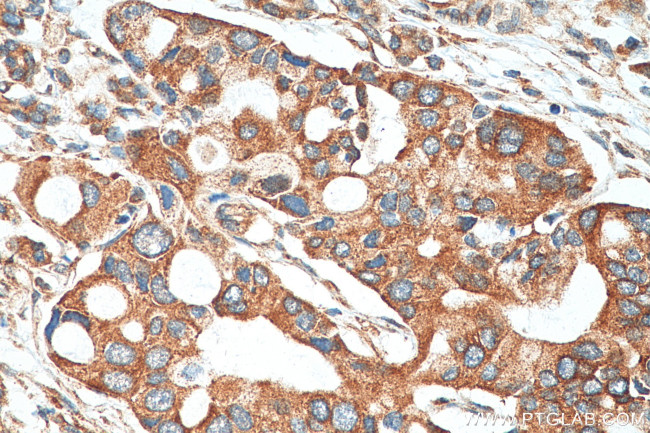 DCLK1 Antibody in Immunohistochemistry (Paraffin) (IHC (P))