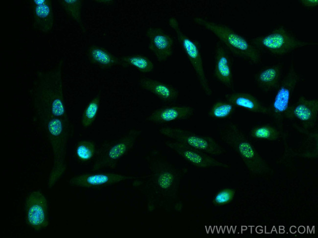 RGS12 Antibody in Immunocytochemistry (ICC/IF)