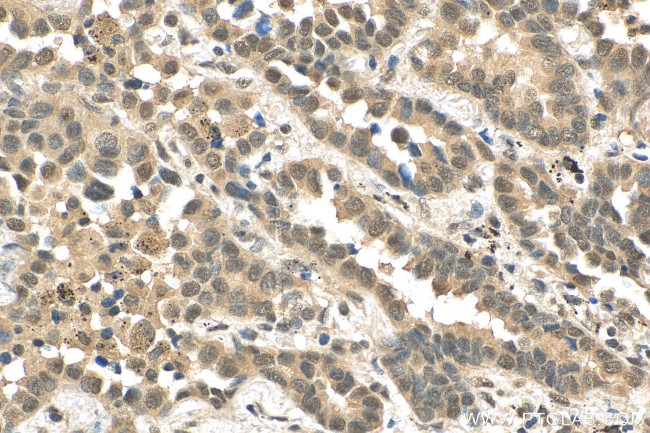 PPP1R13B Antibody in Immunohistochemistry (Paraffin) (IHC (P))