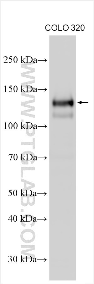 SPINK5 Antibody in Western Blot (WB)