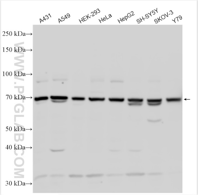 CAPN5 Antibody in Western Blot (WB)