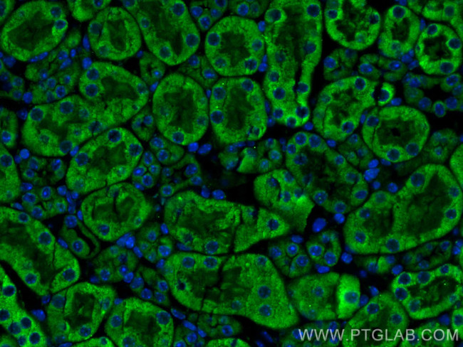 CX3CR1 Antibody in Immunohistochemistry (PFA fixed) (IHC (PFA))