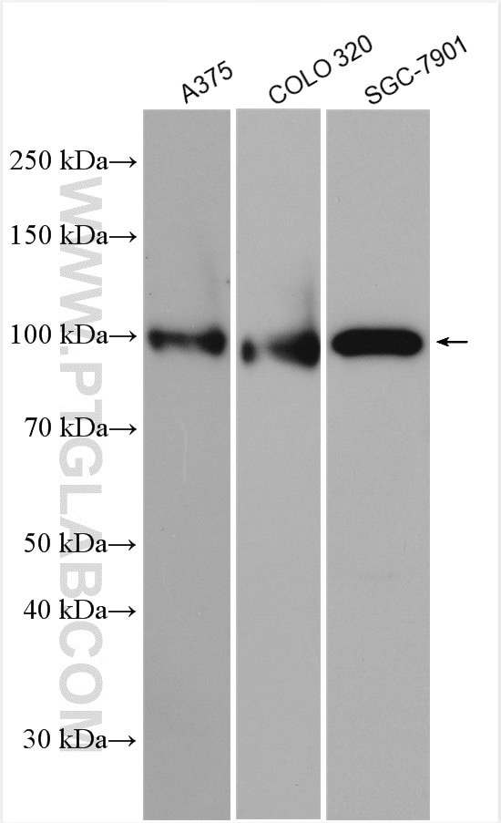 ESCO1 Antibody in Western Blot (WB)