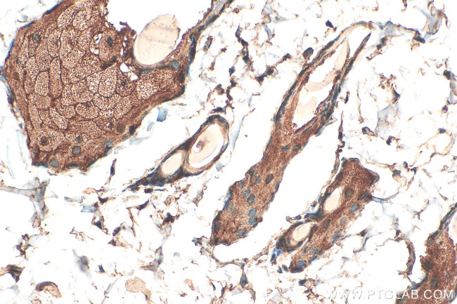 RELL1 Antibody in Immunohistochemistry (Paraffin) (IHC (P))