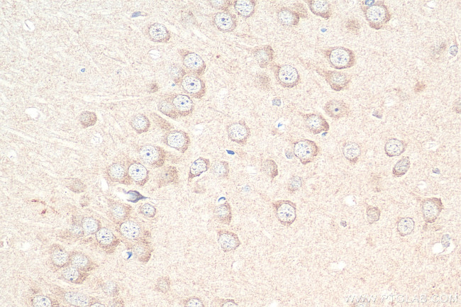 SLC5A8 Antibody in Immunohistochemistry (Paraffin) (IHC (P))