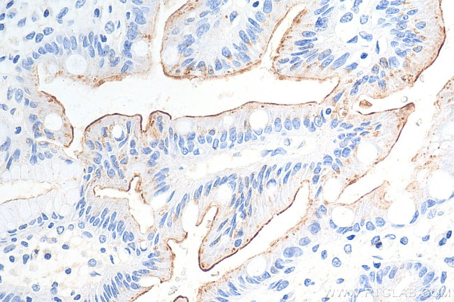 MUC13 Antibody in Immunohistochemistry (Paraffin) (IHC (P))