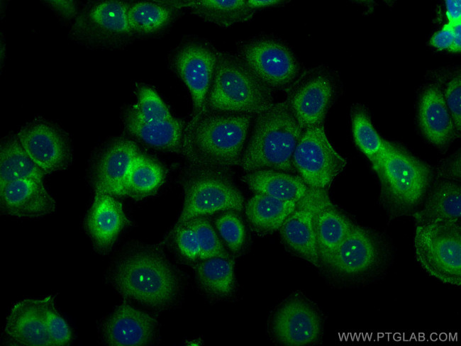 RPS23 Antibody in Immunocytochemistry (ICC/IF)