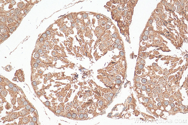 RALGAPA2 Antibody in Immunohistochemistry (Paraffin) (IHC (P))