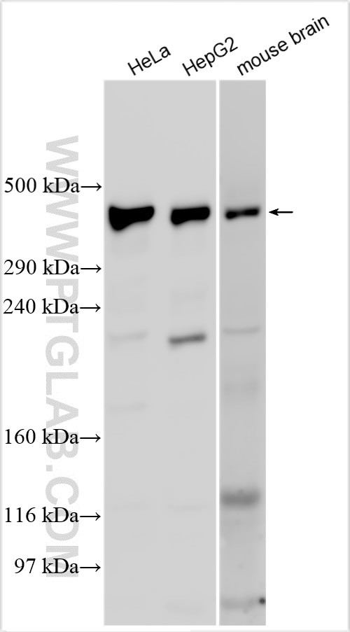 VPS13C Antibody in Western Blot (WB)