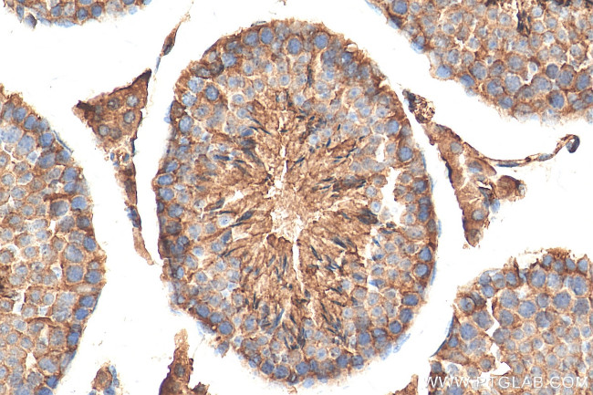 STK24 Antibody in Immunohistochemistry (Paraffin) (IHC (P))