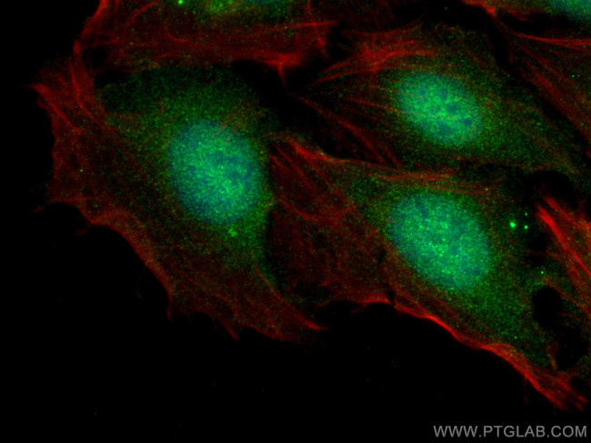 GARNL1 Antibody in Immunocytochemistry (ICC/IF)