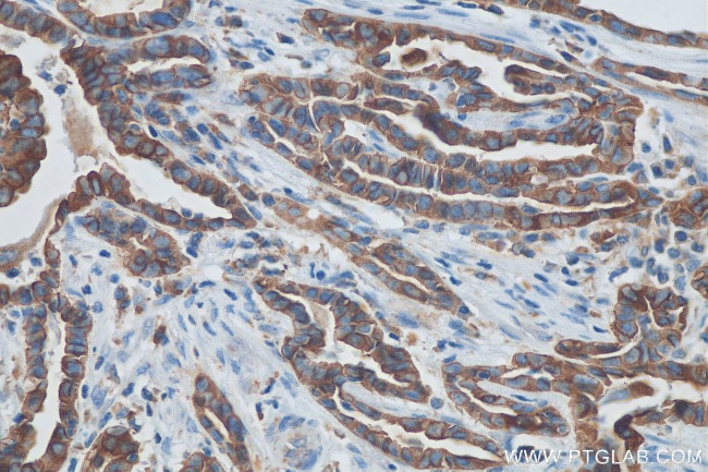 Cytokeratin 19 Antibody in Immunohistochemistry (Paraffin) (IHC (P))
