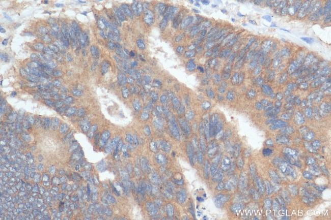 ENT1 Antibody in Immunohistochemistry (Paraffin) (IHC (P))