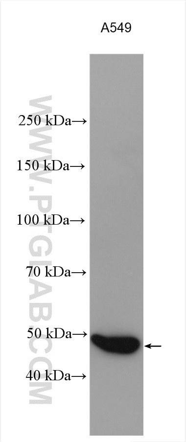 ADRB2 Antibody in Western Blot (WB)