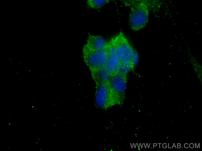 AP2A1 Antibody in Immunocytochemistry (ICC/IF)