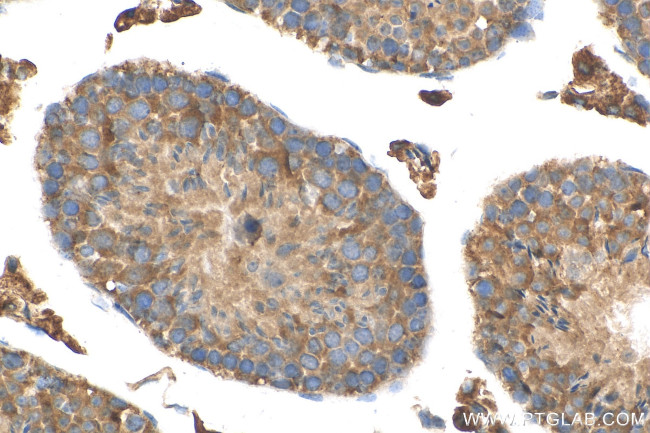 MEI4 Antibody in Immunohistochemistry (Paraffin) (IHC (P))