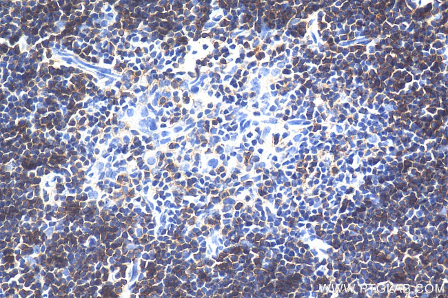 CD8a Antibody in Immunohistochemistry (Paraffin) (IHC (P))