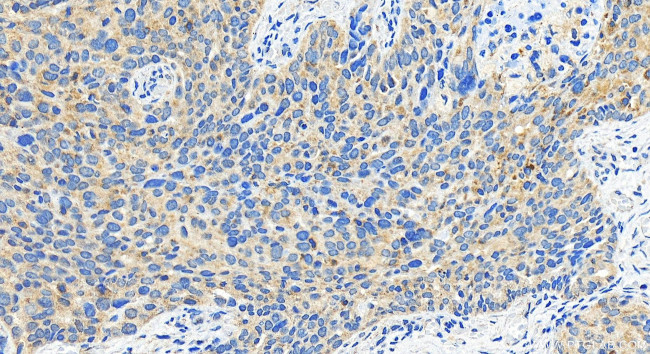 IFIT1 Antibody in Immunohistochemistry (Paraffin) (IHC (P))