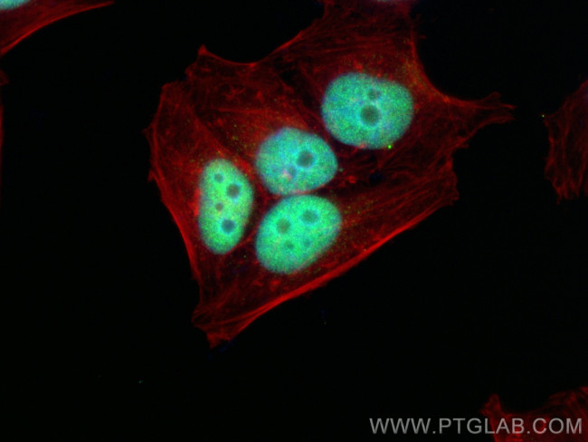 NFIB Antibody in Immunocytochemistry (ICC/IF)