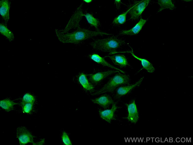 CRELD1 Antibody in Immunocytochemistry (ICC/IF)