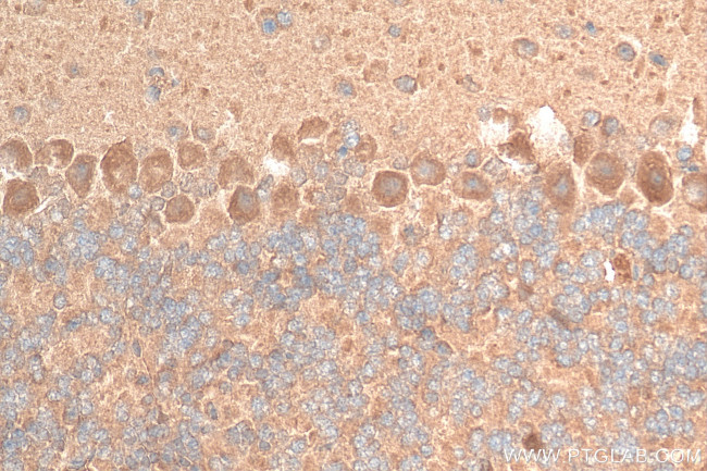 TRIM69 Antibody in Immunohistochemistry (Paraffin) (IHC (P))
