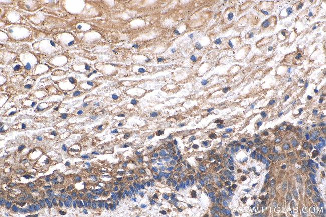 OTUD1 Antibody in Immunohistochemistry (Paraffin) (IHC (P))