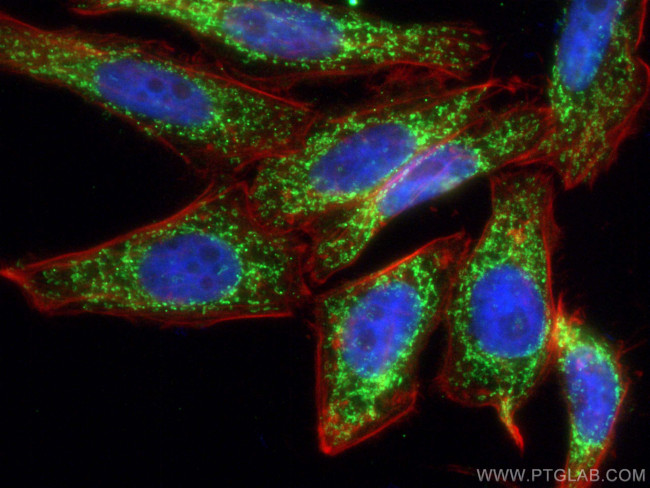 SPATS2L Antibody in Immunocytochemistry (ICC/IF)