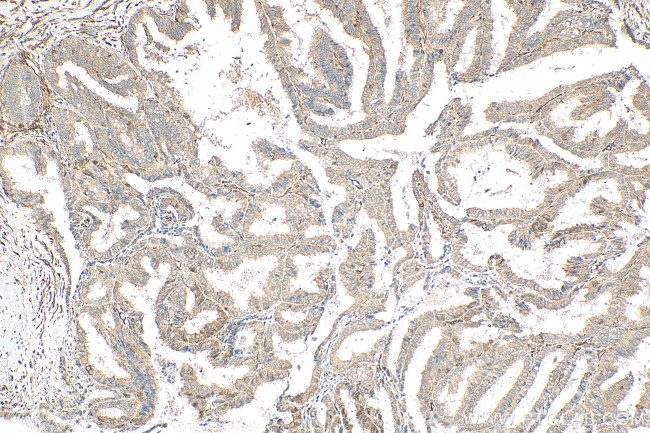 NCAPG Antibody in Immunohistochemistry (Paraffin) (IHC (P))